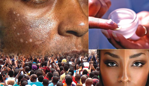 skin lightening products! Watch Al Jazeera feature on Nigeria’s Skin